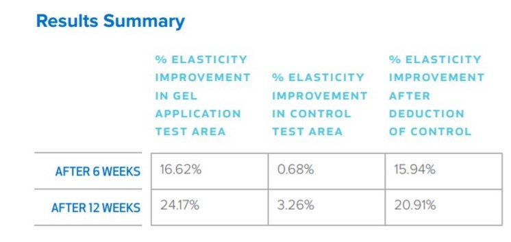 elasticity